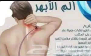 خبير الابهر